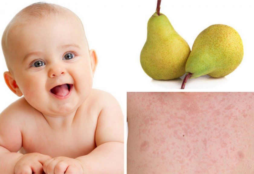 Алергія у дитини на груші