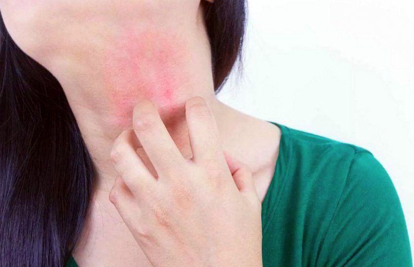Симптоми алергії на мигдаль у дорослих